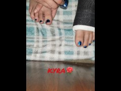 XMAS Toe Painting While In Foot Cast
