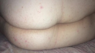 Я никогда не перестану мочиться в постель, кто думает, что мне нужны подгузники?