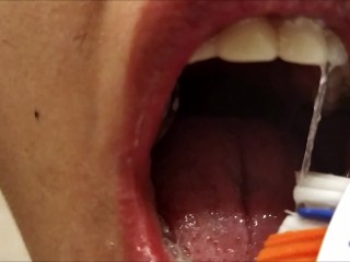 My first Full Mouth Check - Short Version