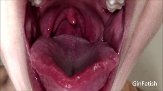 Tongue and uvula check with lots of spit (Short version)