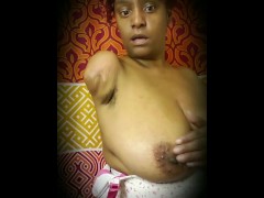 Stump Lovers Closeup