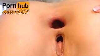 Open Wide Anal Gape And Asshole