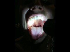 Tongue and Throat Exam (with and without flashlight)