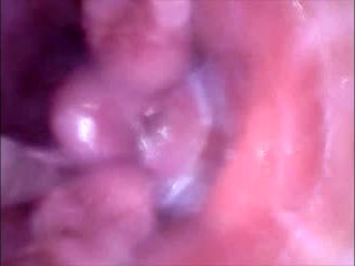 Spectulum in Pussy and Filmed from the inside as it is Filled with Cum 1