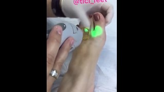 tici_feet @tici_feet laser in my feet