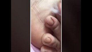 @tici_feet tici feet IG tici_feet снятие полироли (предварительный просмотр)
