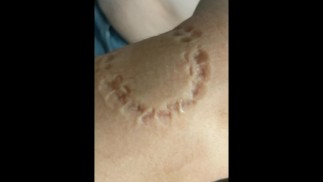 Кусание Часть 2