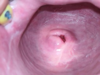 Cervix Van Dichtbij (4K)