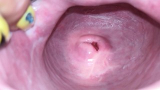 4K Close-Up Of The Cervix