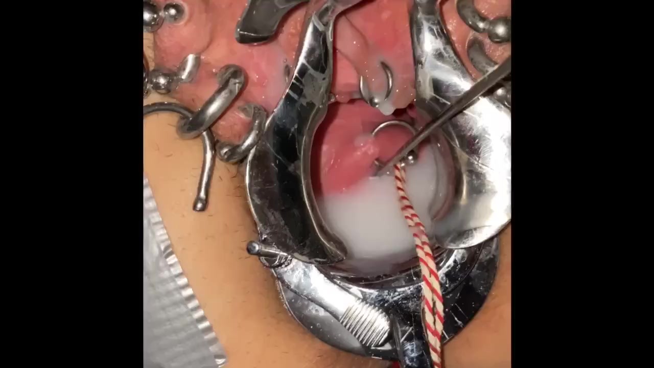 Cervix torture porn