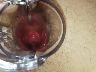 Trying to look in my Hole - Speculum