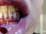 Mouth, uvula, tongue, teeth checks and endoscope (Short version)