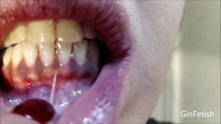 Boca, úvula, lengua, controles de dientes y endoscopio (Versión corta)