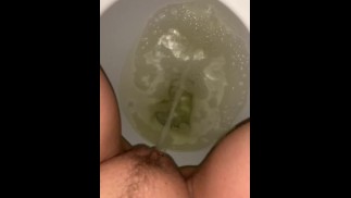 强烈的泡沫性早晨小便