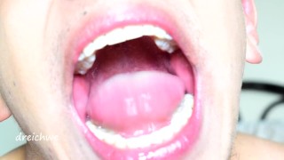 Uvula fetish