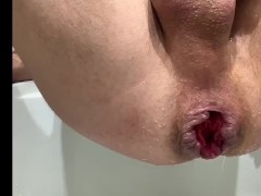 Prostate shower ( Промывка анала) - Screenshot 5 of 16 - Prostate Shower