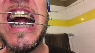 Geiler Deepthroat voller Spucke mit Zahnspange und doppelter Kopfbedeckung