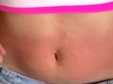 I show my red belly from the torture I received from the red belly game, my stomach inflamed