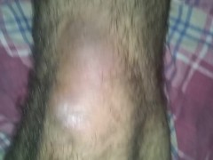My Stumps