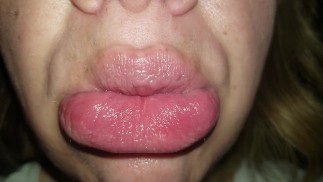 Extreme Pucker