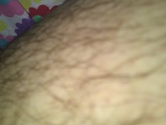 Hairy Stumps