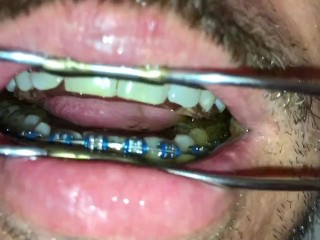 New Horny Deepthroat after Pissing on my Braces