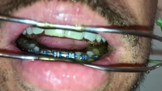 Neuer geiler Deepthroat nach dem Pissen auf meine Zahnspange