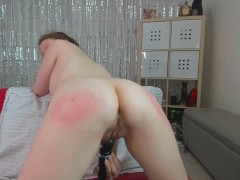 First Cam Show Post Surgery