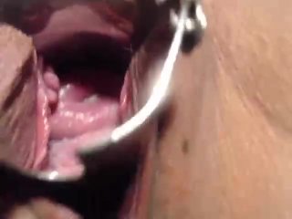 Speculum in My Pussy andCervix Show Close Up