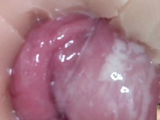 Andrada pussy endoscope fuck - 10/8