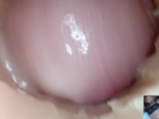 Preview 1 of Andrada endoscope pussy fuck - 10/10