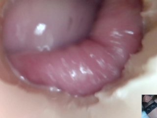 Andrada endoscope pussy fuck - 10/10