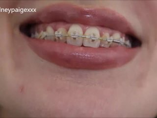 SydneyPaige Teases You to Cum_All Over_Her Braces