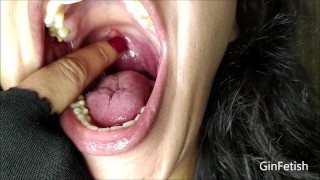 Mouth exam thumbnail