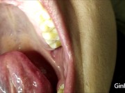 Preview 5 of Mouth Exam (Short version)