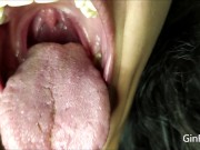 Preview 6 of Mouth Exam (Short version)