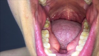 Mouth exam in front of the camera thumbnail