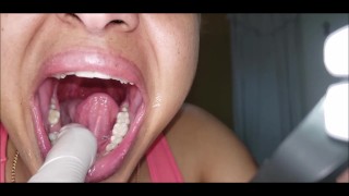 Осмотр полости рта (Краткая версия)