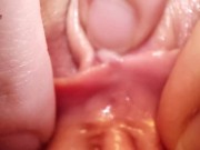 Preview 2 of Extreme Pussy Close Up. Vaginal dilator