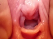 Preview 3 of Extreme Pussy Close Up. Vaginal dilator
