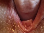 Preview 4 of Extreme Pussy Close Up. Vaginal dilator