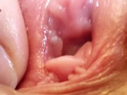 Preview 6 of Extreme Pussy Close Up. Vaginal dilator