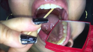Toothpick and mouth check thumbnail