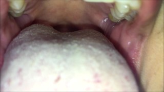 My morning breath and white tongue