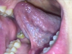 My morning breath and white tongue (Demo version)