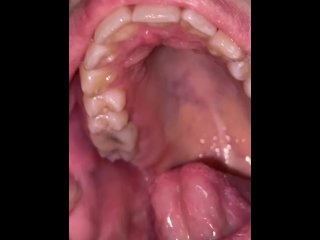 teeth fetish, tongue fetish, mouth, girl mouth uvula