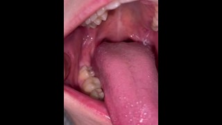 口蓋垂は非常に近いビューの吐き気を示します