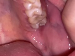 Dental examination. Teeth tour