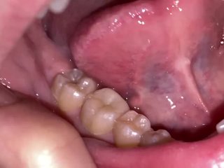 uvula, teeth fetish, teeth, mouth closeup