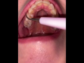 teeth cleaning, dental cleaning, mouth teeth fetish, mouth show